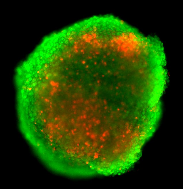 Novel-Microfluidic-Platform-Cancer-Research